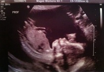 Any amusing pregnancy scan pictures?