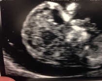 Scan pics