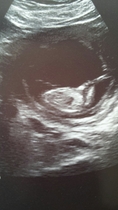 Gender guesses please!