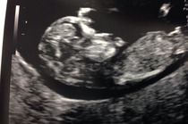Scan pics