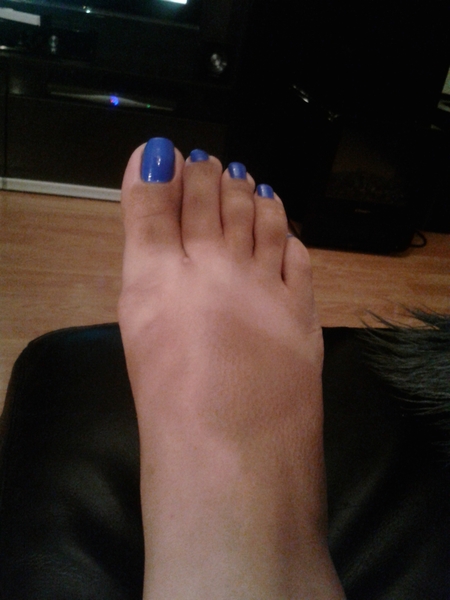 Quick question, best remover of nasty rough skin on heels under £10