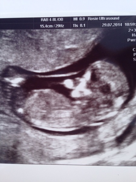 February 2015 #2: Is the first trimester over yet?
