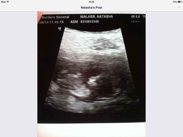 baby gender