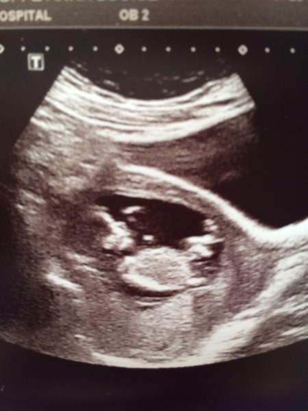 February 2015 #2: Is the first trimester over yet?