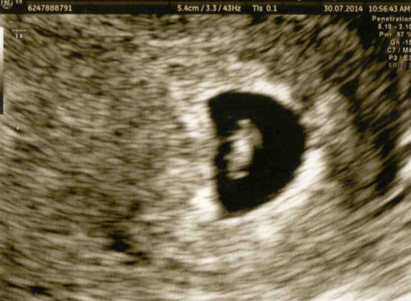 Due March 2015 - on the way to booking in, scans and morning sickness ahoy!