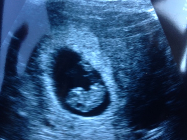 Due March 2015 - on the way to booking in, scans and morning sickness ahoy!