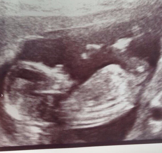 February 2015 #2: Is the first trimester over yet?