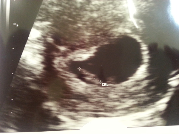 Due March 2015 - on the way to booking in, scans and morning sickness ahoy!