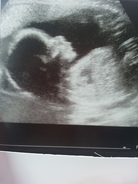 January 2015 - More scans, kicks, hiccups and glowiness - thread #8