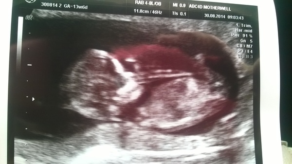 March Mummies 2015 - ever hopeful for the return of sanity and departure of sickness as we approach second tri!