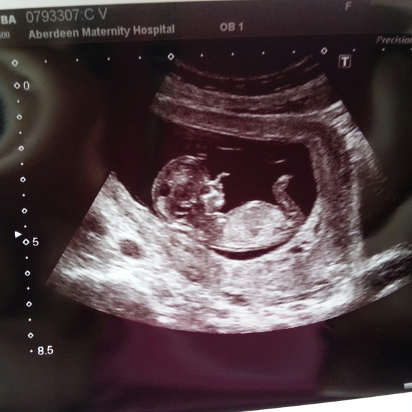 March Mummies 2015 - ever hopeful for the return of sanity and departure of sickness as we approach second tri!