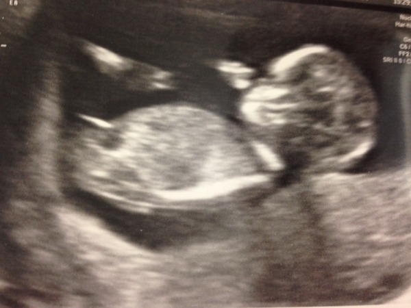 February 2015 #2: Is the first trimester over yet?