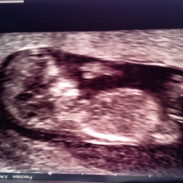 March Mummies 2015 - ever hopeful for the return of sanity and departure of sickness as we approach second tri!