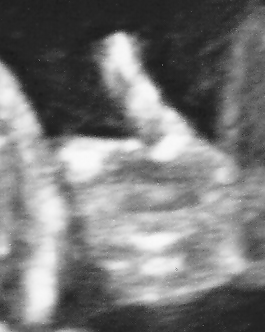 January 2015 - More scans, kicks, hiccups and glowiness - thread #8