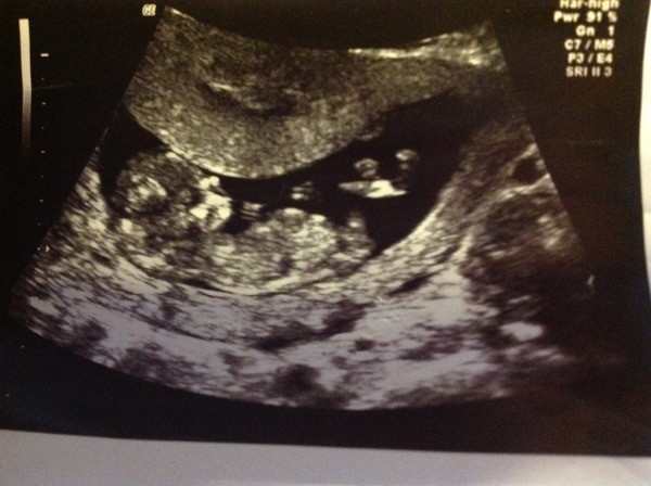 February 2015 #2: Is the first trimester over yet?