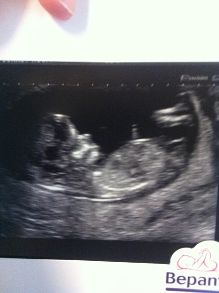 February 2015 #2: Is the first trimester over yet?