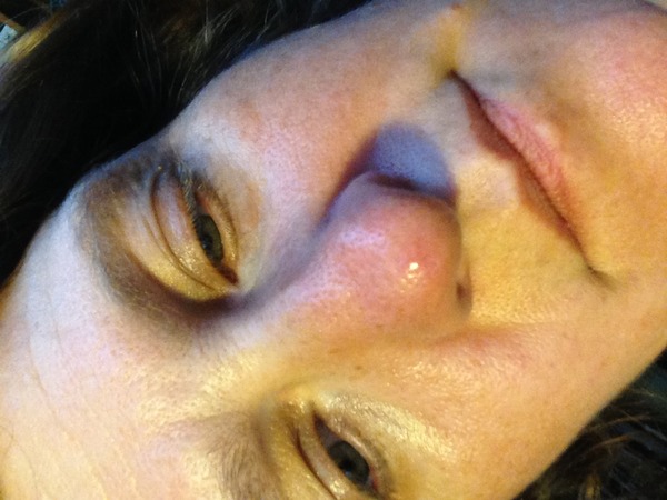 Sporn alert - nose - what to do?