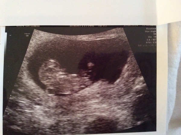 Just Shagging Grads Thread 10 - Roll Up, Roll Up all you graduated Viroids!!!