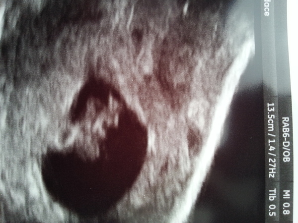 Due March 2015 - on the way to booking in, scans and morning sickness ahoy!