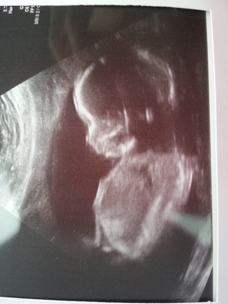 January 2015 - More scans, kicks, hiccups and glowiness - thread #8