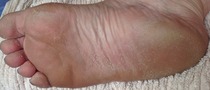 Quick question, best remover of nasty rough skin on heels under £10