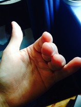 Can anyone tell me what's up with DS's fingers?