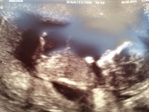 12 week scan..any guesses?