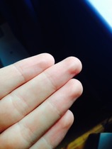 Can anyone tell me what's up with DS's fingers?