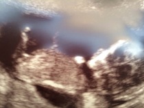 12 week scan..any guesses?