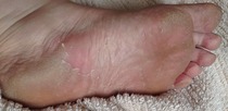 Quick question, best remover of nasty rough skin on heels under £10
