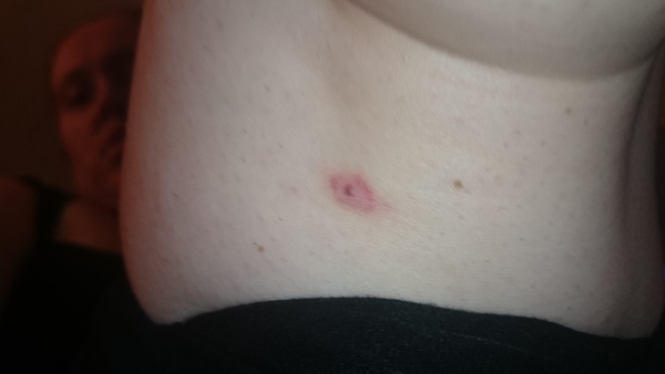 Any idea what the hell this weird spot might be?!
