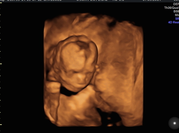 February 2015 #3 - Roll on the Glow!!