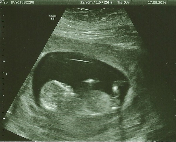 March Mummies 2015 - to second tri and beyond we go, bumps appearing and sickness (hopefully) disappearing