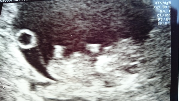 OVER HERE!!! Due April 2015