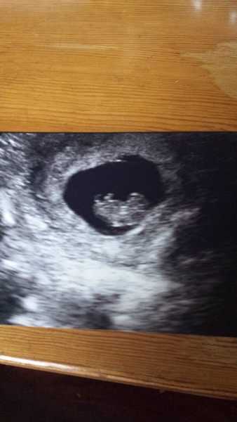 OVER HERE!!! Due April 2015