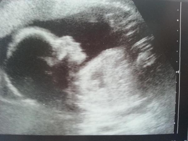 January 2015 - More scans, kicks, hiccups and glowiness - thread #8