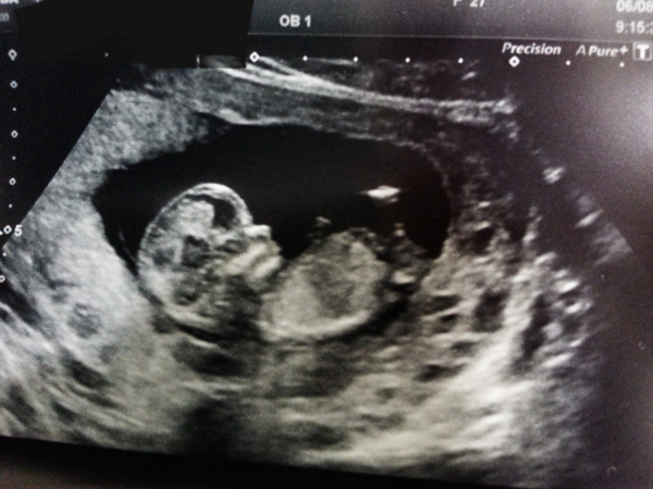 Guess the gender please!