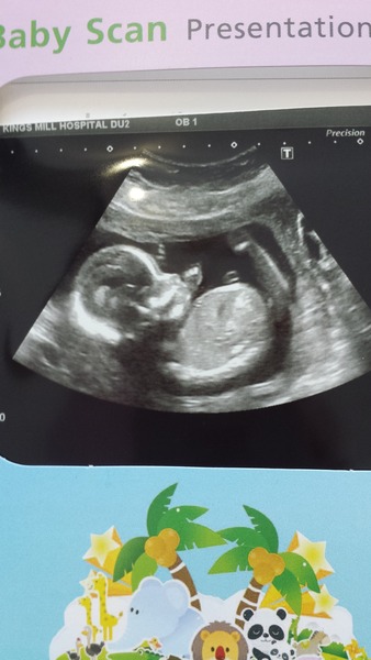 guess the gender .