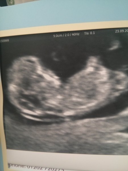 OVER HERE!!! Due April 2015