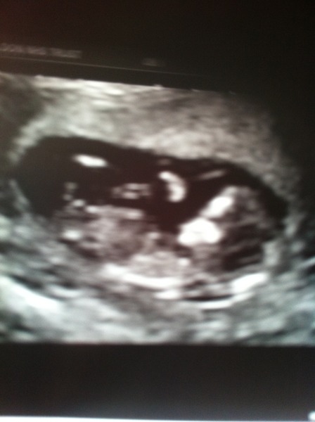 OVER HERE!!! Due April 2015