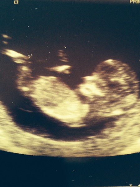 March Mummies 2015 - ever hopeful for the return of sanity and departure of sickness as we approach second tri!