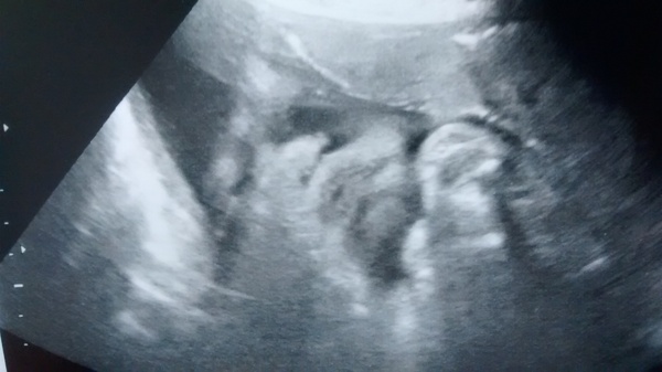 October 2014- thread 13. Getting the eviction notices ready!