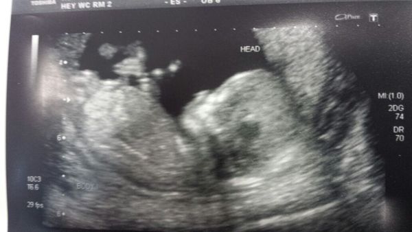 OVER HERE!!! Due April 2015