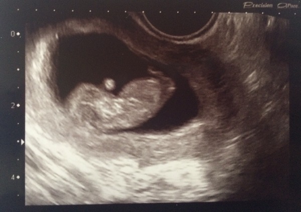 OVER HERE!!! Due April 2015