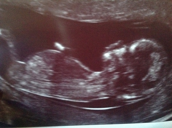 March Mummies 2015 - to second tri and beyond we go, bumps appearing and sickness (hopefully) disappearing