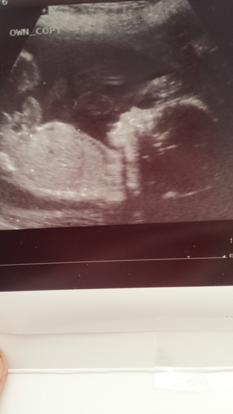 Not so new and not so expert!