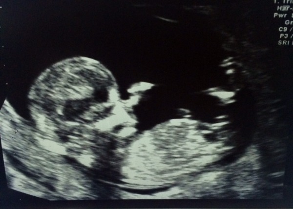 OVER HERE!!! Due April 2015