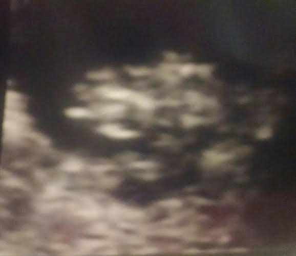 OVER HERE!!! Due April 2015