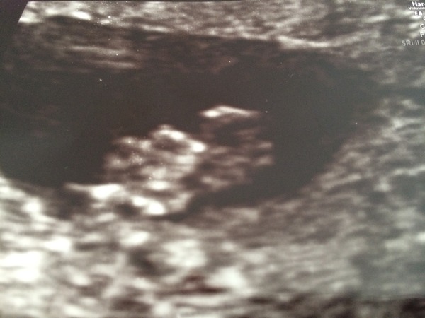 OVER HERE!!! Due April 2015