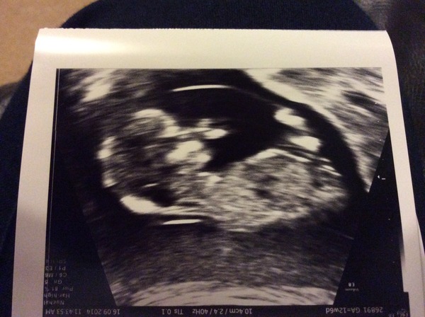 March Mummies 2015 - to second tri and beyond we go, bumps appearing and sickness (hopefully) disappearing